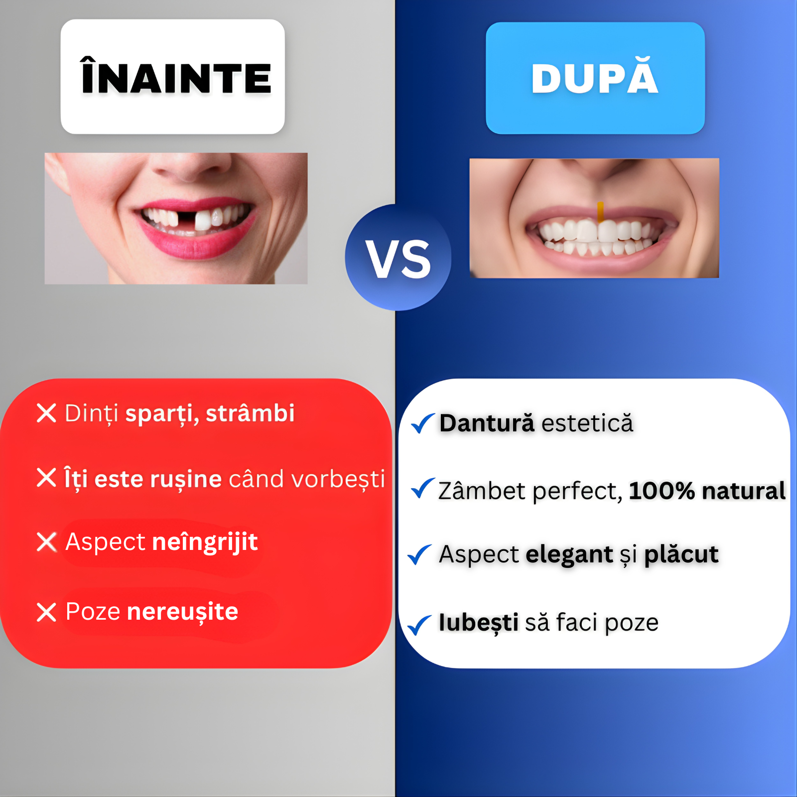 Fațete reutilizabile universale