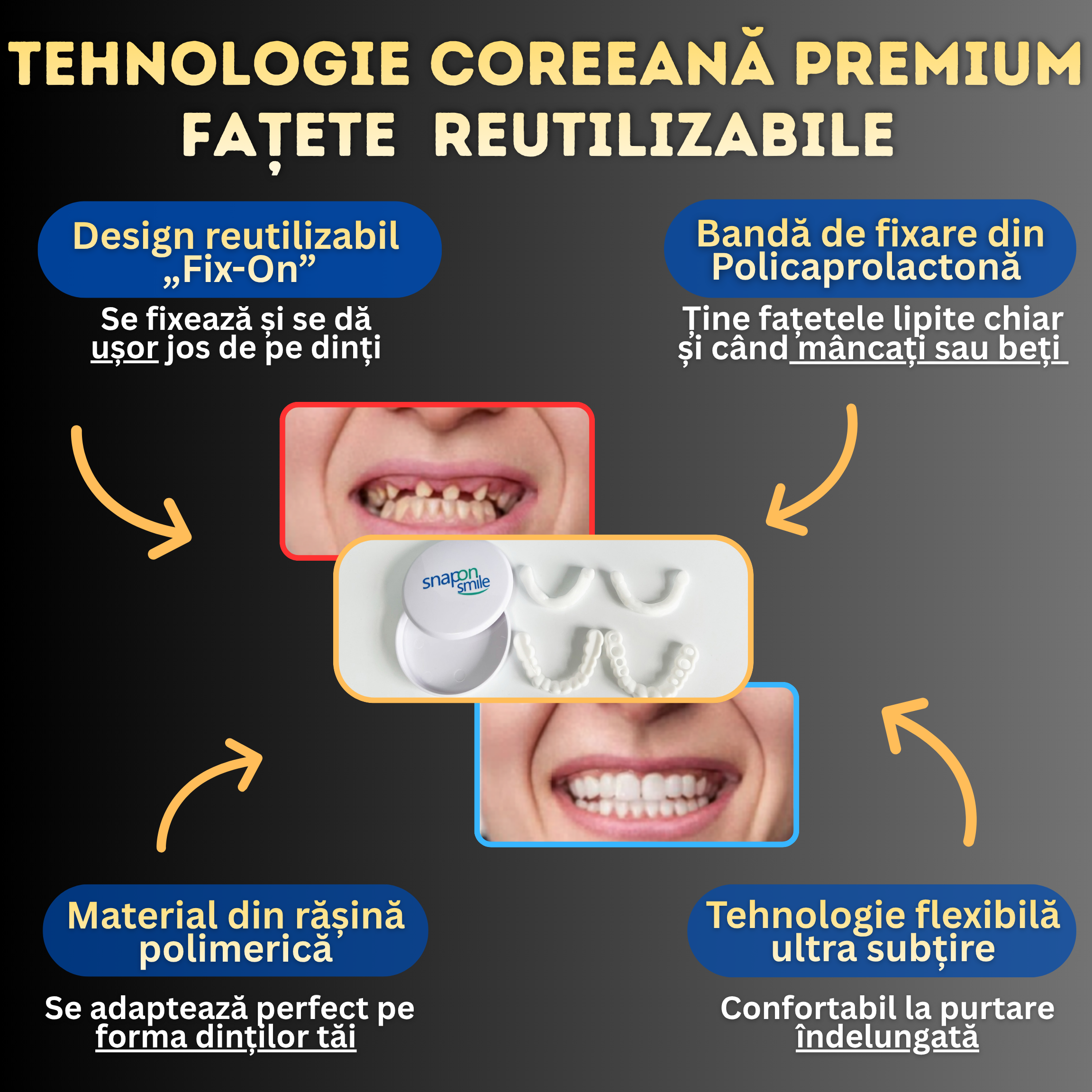 Fațete reutilizabile universale